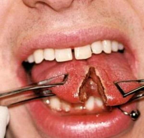 Cool Tongue Piercing Ideas and Care Info0031