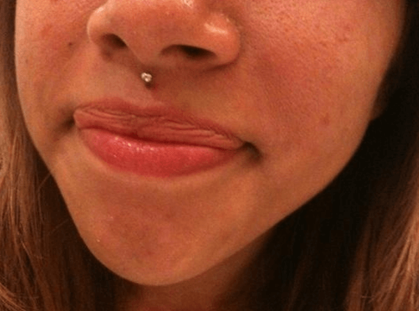 Medusa Piercing ideas 22