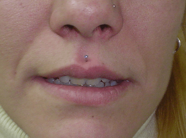 Medusa Piercing ideas 3