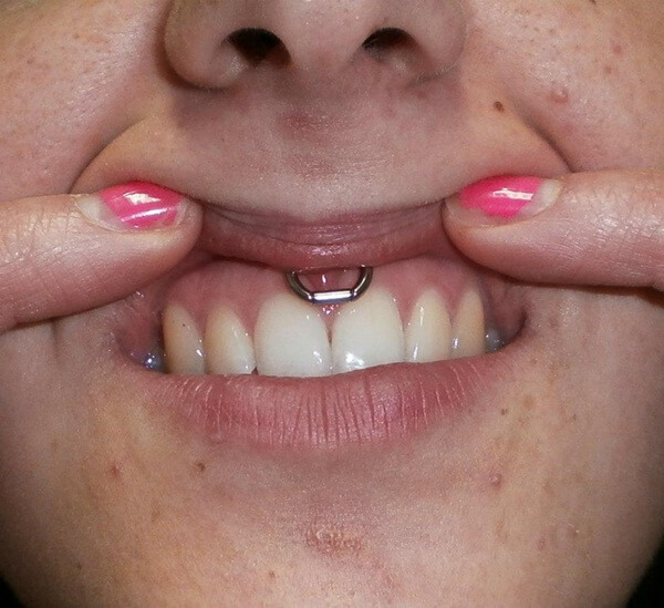 Smiley Piercing designs 44