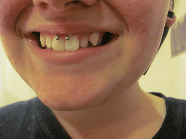 Smiley Piercing designs 66