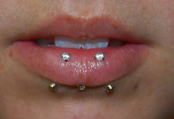 double lip piercing (78)