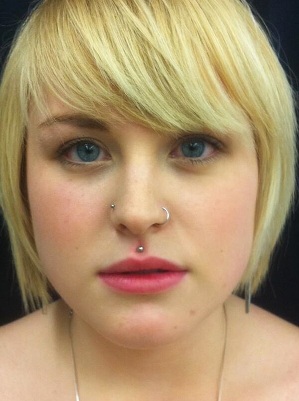 philtrum piercing (80)