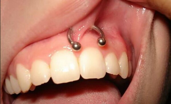 piercing frenillo (12)