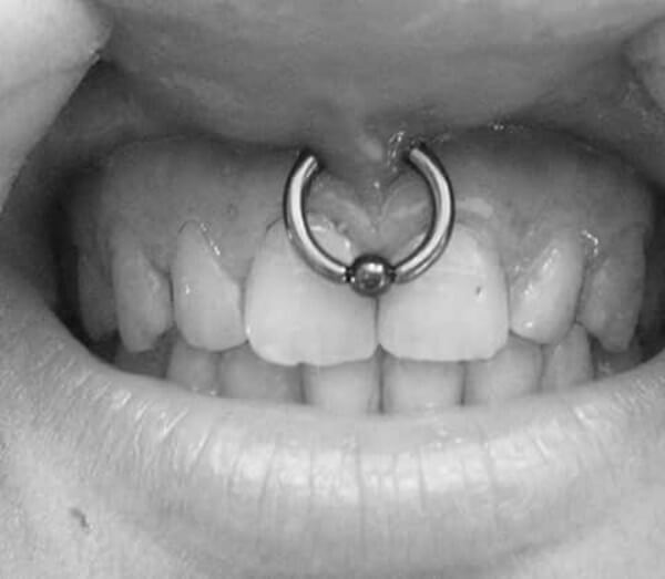 piercing frenillo (24)