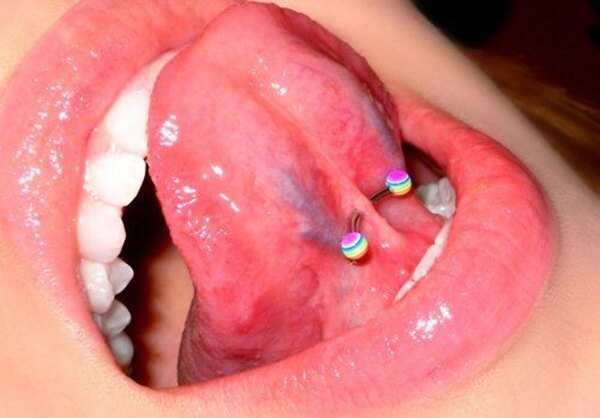 piercing frenillo (3)