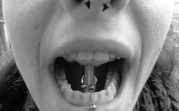 piercing frenillo (4)