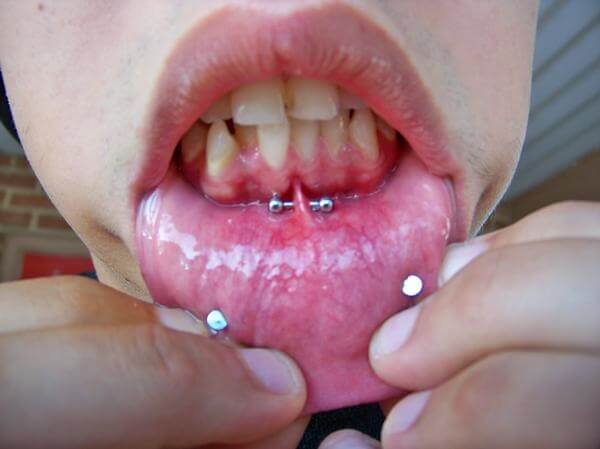 piercing frenillo (41)