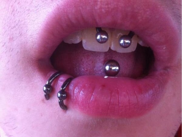 piercing frenillo (59)