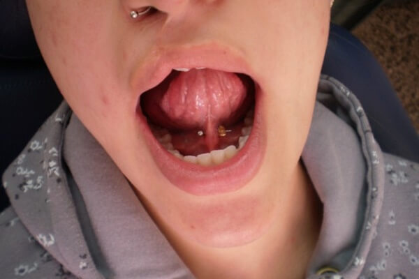 piercing frenillo (80)